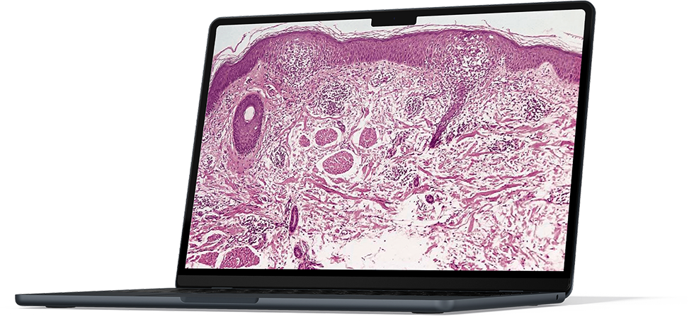 Laminário virtual exclusivo MedCof Derma